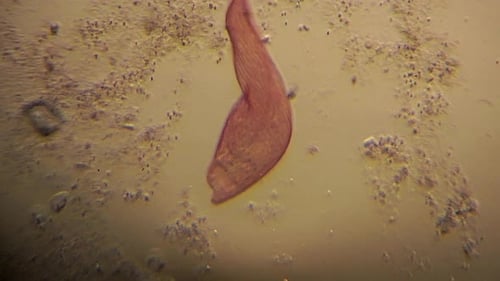 Les
blépharismes microscopiques se déplacent à l'aide de cils.