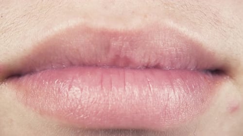 Tirantes en los dientes y la sonrisa primer plano