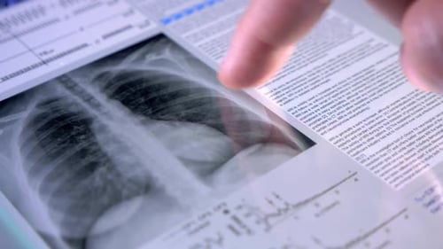 Medical Tablet Close Up