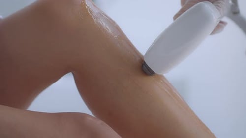 Laser Hair Removal Treatment in a Medical Setting