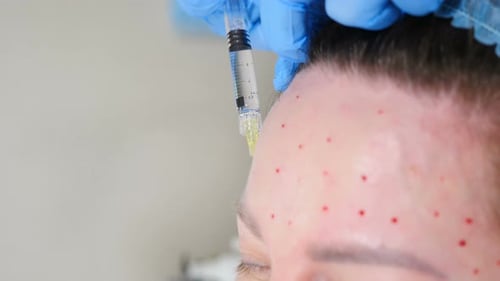 Injecting Face for Medical Procedure Close Up