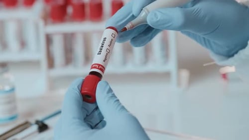 Marking Positive Ebolavirus Test in a Lab