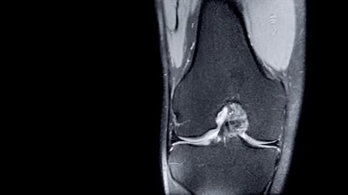 Knee Joint MRI Scan Medical Visualization