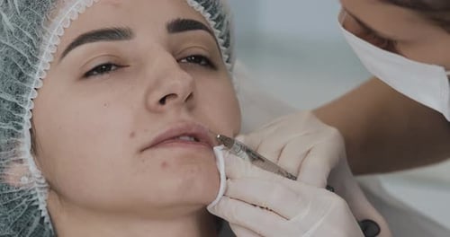 Woman Receiving Lip Injections at a Clinic