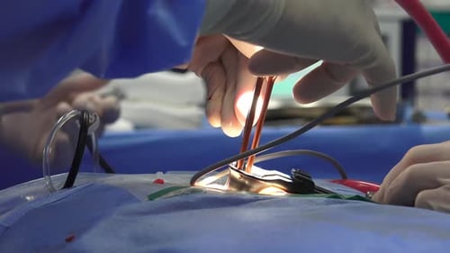 Chirurgie de la colonne vertébrale
