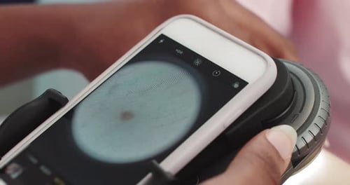 El dermatólogo examina una piel