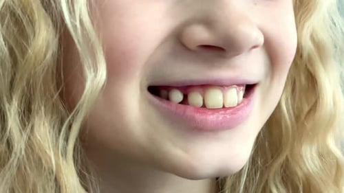 Menina loira caucasiana sacudindo a língua, leite, dente na boca, odontologia infantil, estomatologia e