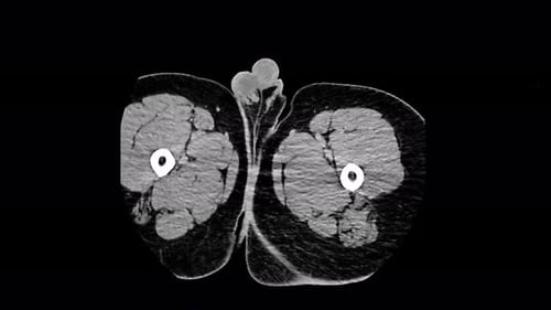 Computed Medical Tomography MRI Upscaled Scan of Human Illness