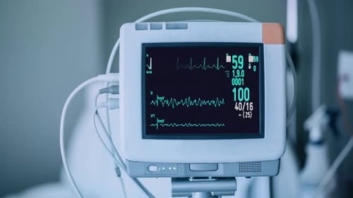 Heart Rate Monitor in Hospital Theater. Medical Vital Signs Monitor Instrument in a Hospital