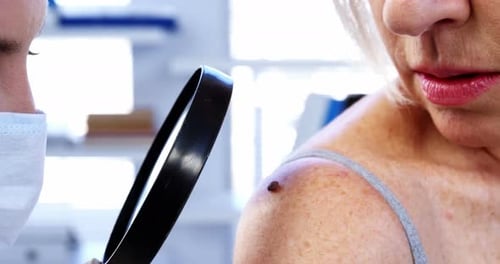 Doctor Examines Mole on Senior Patient Shoulder