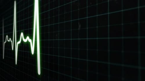 Heart Rate Monitor Electrocardiogram Medical Monitor