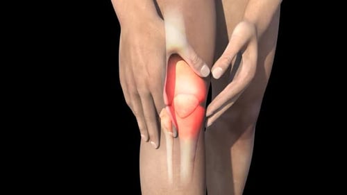 Human Knee Pain 3D Medical Anatomy Animation