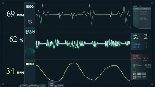 Anzeige des Elektrokardiogramms im Normalmodus