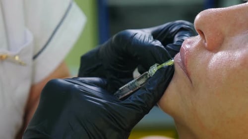 Lip Injection Procedure in Medical Office Close Up