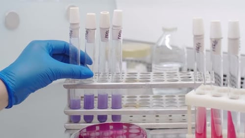 The Gloved Hand of the Medic Takes a Flask of Blue Tests From the Stand. Close-up, Hand Lifts a Test