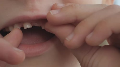 Change of Baby Teeth in a Child