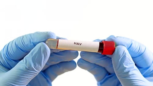 Close Up of Hands Holding Blood Sample Labeled HAV