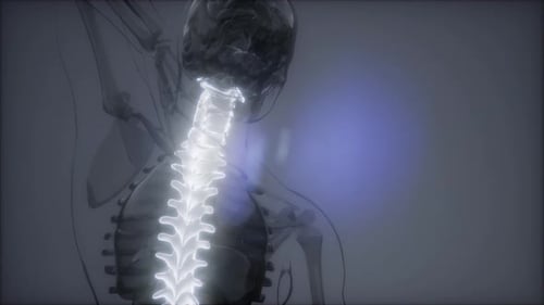 Backache in Back Bones