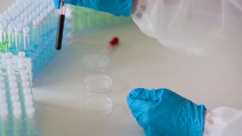 Blood Sample Analyzed in Medical Lab