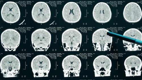 Hand points to Brain Scan images