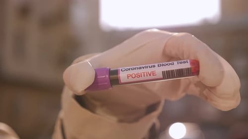 Coronavirus Blood Test Showing Positive Result