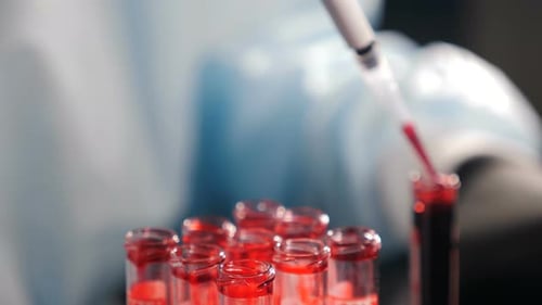 Blood Samples Analyzed with Pipette in Lab