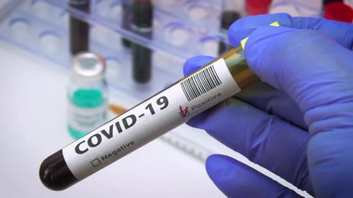 Coronavirus blood test