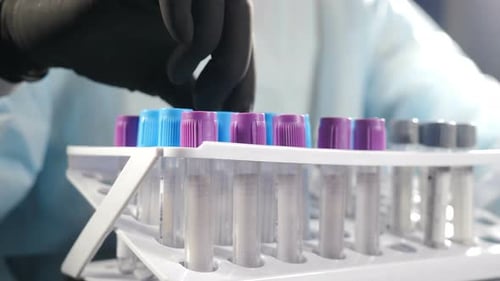 Test Tubes Lined Up in Rack, Close Up