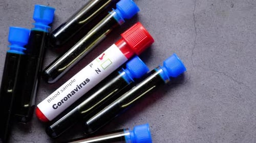 Close Up of Corona Virus Blood Test Tube on Black Background
