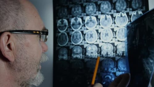 Elderly scientist in glasses reviewing brain MRI