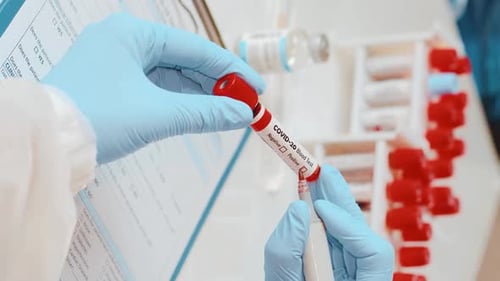 Positive COVID-19 Blood Test Marked by Gloved Hand