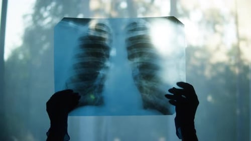 Halten des Röntgenbildes der menschlichen Brust auf dem Fensterhintergrund Arzt überprüft Fluorographie des Patienten auf
