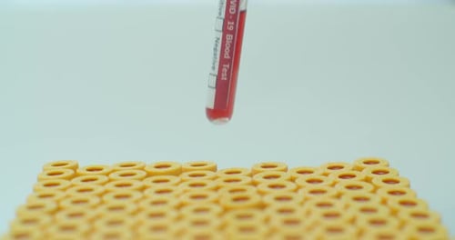 Hands in Blue Rubber Gloves Put in the Tube To a Rack for Test Tubes and Checking Covid-19 Close Up