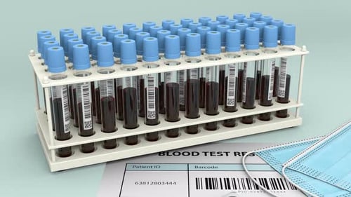 Blood Test Results Negative with Medical Supplies Animation