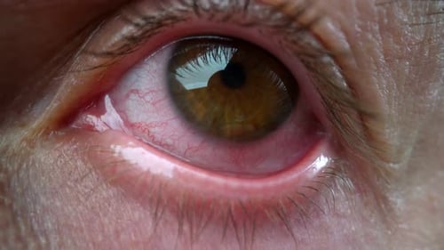 Extrême gros plan yeux avec des blancs rouges après un long travail d'insomnie à l'ordinateur