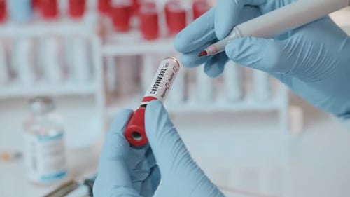 Marking Coronavirus Test Tube as Positive in Lab