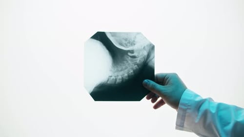 Hand Holding X-Ray in Hospital Lab
