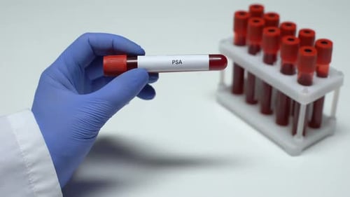 Close Up Of A PSA Blood Test