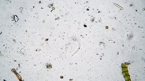 A Long Worm Is a Nematode Surrounded By Many Bacteria