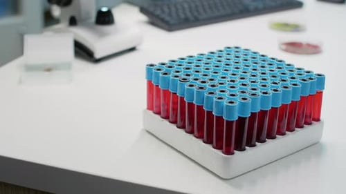 Close Up of Vacutainers Tray with Blood on Desk