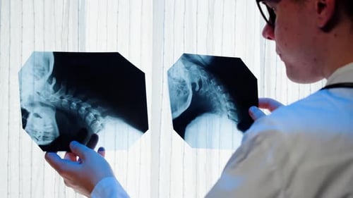 Doctor Examining Neck Xray Closeup