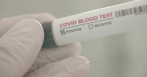Positiver Covid-19-Bluttest