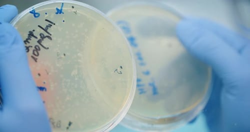 Scientist Looking at Bacteries in Petri Dish at Laboratory