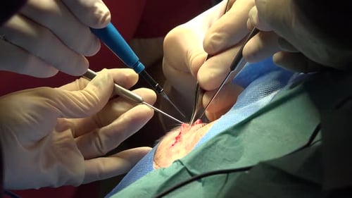 Eyelid Surgery