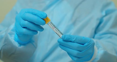 COVID-19 Negative Blood Test Result