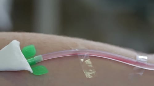 Primer plano de la transfusión de sangre