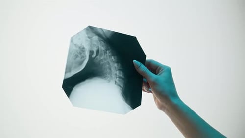 Hand Holding Medical X-Ray in Studio