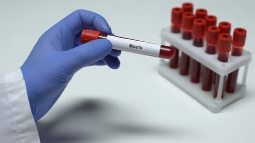 Test de paludisme, médecin montrant un échantillon de sang dans un tube, recherche en laboratoire, bilan de santé