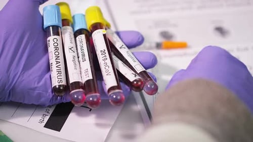 Coronavirus-Test