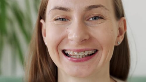 Smiling Young Adult Woman Shows Teeth with Braces